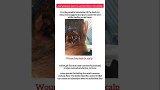 Facts about house fly disease biology biologyexam shortviral shortfeed youtubefeed viral [upl. by Ahseekal]