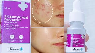 2 salicylic acid face serum review  Salicylic face serum  How to use salicylic acid on face [upl. by Deane269]