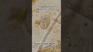 Balantidium coli trophozoite  Protozoa  stool examination 40X  shorts [upl. by Gaskins]