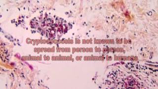 Cryptococcus Fungi The Cause of Cryptococcosis [upl. by Kenwee]