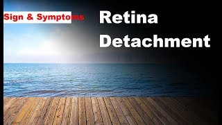 Retinal Detachment Hindi [upl. by Hewet335]