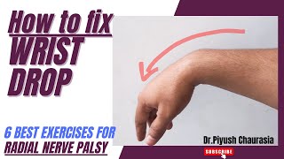 Physiotherapy Treatment Of Wrist DropEffective Exercises For Radial Nerve Palsy [upl. by Bresee135]