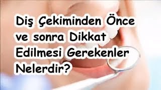 Diş Çekiminden Önce ve sonra Dikkat Edilmesi Gerekenler Nelerdir [upl. by Ahsaercal705]