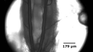 Quantification of Drosophila Larva Heart Function Using Microfluidics by Alireza Zabihihesari [upl. by Adrell]