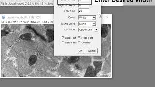 Electron Microscopy Images Postprocessing steps in Image J [upl. by Ellerred]