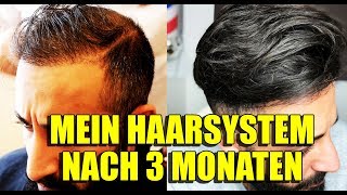 MEIN HAARSYSTEM NACH 3 MONATEN  VOLLE HAARE OHNE OP  BARTMANN [upl. by Nwahser]