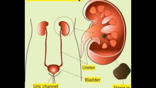 What Is the Difference between Cysteine and Cystine [upl. by Bushore]