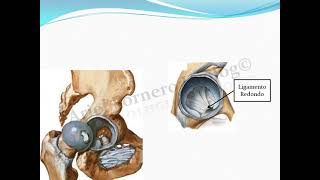 Articulación Coxofemoral [upl. by Bahner748]