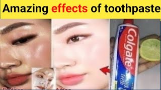 Toothpaste and lemon for skin whitening  Skin whitening home remedies live results  Lemon amp coffee [upl. by Stutzman]