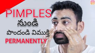 Get Rid of Pimples amp Acne Permanently in 2 Steps Works 100  Fit Tuber Telugu [upl. by Nepsa]