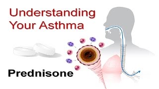 Understanding Your Asthma Part 5 Prednisone [upl. by Anhavas]