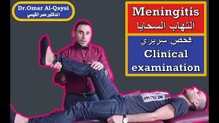 meningitis quotclinical examinationquot I الفحص السريري لالتهاب السحايا [upl. by Mickelson628]