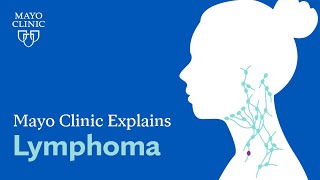 Mayo Clinic Explains Lymphoma [upl. by Enetsirk747]