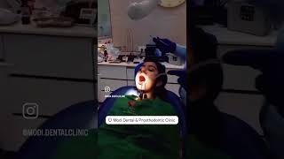 Cyst removal surgery at DR MODI’S DENTAL CLINIC [upl. by Egor564]