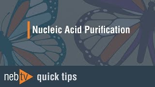 Quick Tips  How can I efficiently elute large DNA fragments from agarose gels [upl. by Eceerehs]