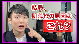 【美容】もっと早く知りたかった！意外と知られていない根本的なニキビ対策！！ [upl. by Schilit628]