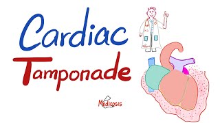 Cardiac Tamponade  Causes Symptoms Signs Diagnosis amp Treatment  Cardiology Series [upl. by Ahcas96]