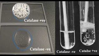 Microbiology catalase test [upl. by Trula]