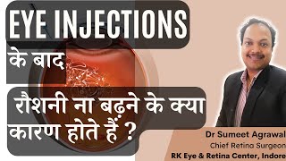 EYE INJECTION के बाद क्या रौशनी नहीं बढ़ी  जानिये इसके कारण [upl. by Notlem]