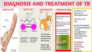 Diagnosis and treatment of Mycobacterium TB  Tuberculin mantoux test  Medical micro Part3 [upl. by Iznek2]