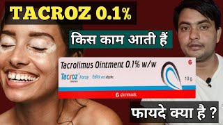 tacroz forte 01 ointment  tacroz ointment 01  use in hindi [upl. by Edna340]