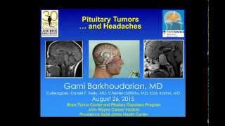 Headaches and Pituitary Tumors [upl. by Amena431]