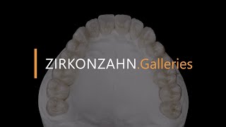 Complete restoration made with Prettau® 4 Anterior® zirconia  ZirkonzahnGalleries [upl. by Romeo]