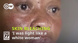 Skin bleaching The risks behind the beauty craze│DW The 77 Percent [upl. by Pacifa]