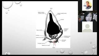 Haematoma in dogs [upl. by Harret]