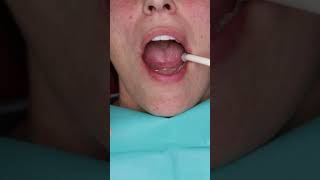 Dental implant’s All on 4 in Prague shorts dentist dental implant veneers short [upl. by Natanoj]