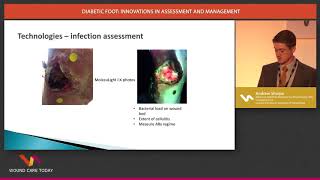 Diabetic Foot innovations in assessment and management  Andrew Sharpe [upl. by Sicular]