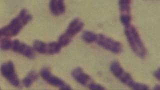 Cytogenetics Human chromosomes Karyotype [upl. by Kellene]