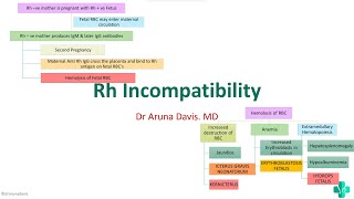 Rh Incompatibility HEMOLYTIC DISEASE OF NEWBORN Erythroblastosis Fetalis [upl. by Omrellig]