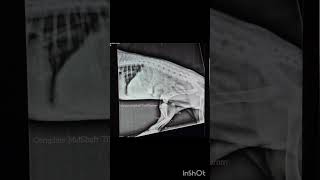 Intramedullary Pinning By Normograde Method For Correction Of Complete Closed Tibial Fracture In Dog [upl. by Fechter940]