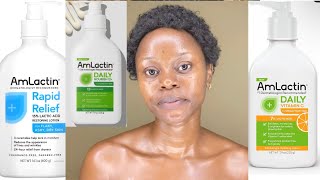 AMLACTIN LOTION REVIEW  HOW TO USE AMLACTIN LOTION FOR BEST RESULT  Amlactin lotion [upl. by Acihsay918]