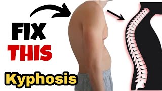 kyphosis correction exercises at homeHow to correct upper body postureपीठ के कूबड़ को कैसे ठीक करे [upl. by Glory]