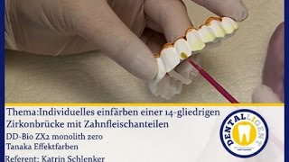 ZahntechnikFärbetechnikTeaserIndividuelles einfärben einer OKZirkonbrücke mit Zahnfleisch [upl. by Nnarual]