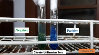 Citrate Utilization Test Positive and Negative Demonstration [upl. by Hecklau]