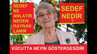 SEDEF NE ANLATIR NEDEN KAYNAKLANIR quotSEDEF DERDÄ°NDEN BÄ°R TÃœRLÃœ KURTULAMIYORUMquot DÄ°YENLER [upl. by Marna994]