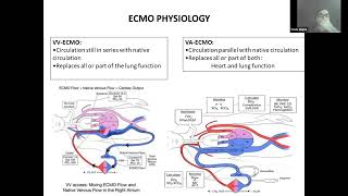 01 Ventilation strategy during ECMO by Dr Vivek Gupta ECMO INDIA OCT 2024  Day 02 [upl. by Esmerelda]