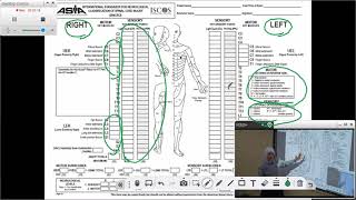 Introduction to American Spinal Injury Association Scoring Sheet [upl. by Lemmueu]