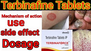 Terbinafine Tablets IP 250mg500mg in hindi Mechanism of action side effects dose [upl. by Anitsirk514]