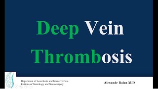 Deep Vein Thrombosis [upl. by Hayarahs378]