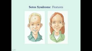 Sotos Syndrome  CRASH Medical Review Series [upl. by Radie]