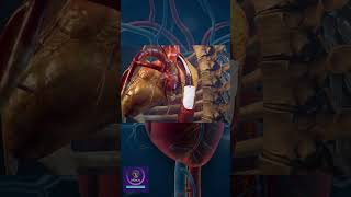 Heart Surgery Angioplasty shorts viral [upl. by Mayor235]