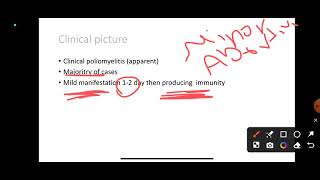 L14 Poliomyelitis COM41 [upl. by Spain]