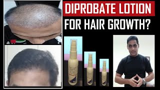 How to use diprovate plus lotion for hair loss Diprobate Lotion Benefits [upl. by Kerry]