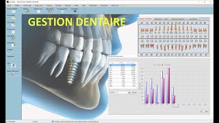 Logiciel gestion cabinet dentaire 22 [upl. by Crescen427]