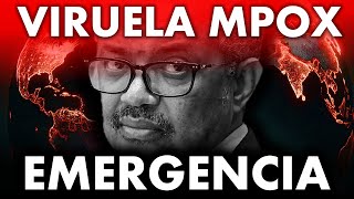 Urgente 💥 VIRUELA DEL MONO será EMERGENCIA SANITARIA INTERNACIONAL [upl. by Adlen]