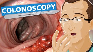 Colonoscopy [upl. by Cinimod]